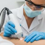 Remoção de Tatuagem: Quanto Custa e Como Funciona o Adeus à Tinta